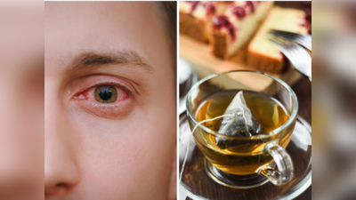 Eye Flu Home Remedies: आई फ्लू से लाल हो रही आंखों को दर्द, जलन और चुभन से तुरंत आराम देंगे ये 5 घरेलू नुस्खे