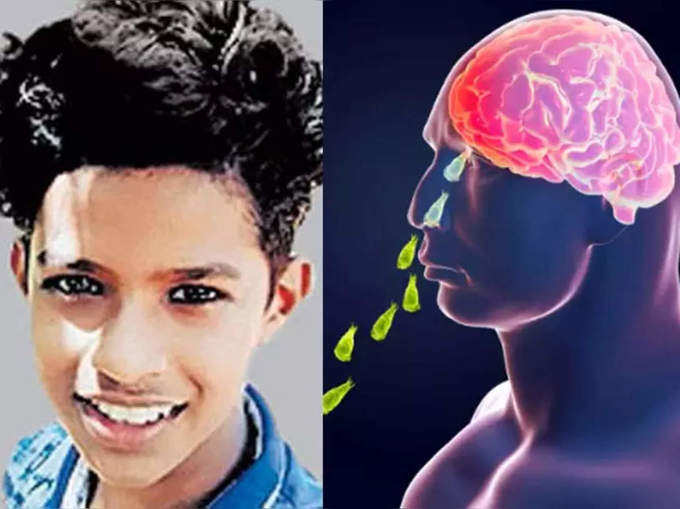 Brain-Eating Amoeba - 15 years boy died in kerala