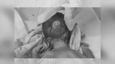गणपती बाप्पासारख्या दिसणाऱ्या बाळाचा जन्म; कान, सोंड पाहून हॉस्पिटलमधील सारेच चकित; पण...