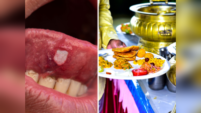 Mouth Ulcers: कोई इलाज नहीं आएगा काम और तेजी से फैल जाएंगे मुंह के छाले, अगर खा ली इनमें से ये 6 चीजें