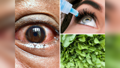 Eye Flu Treatment At Home: आई फ्लू की ड्रॉप से ज्यादा असरदार हैं ये 5 चीजें, दर्द-जलन से जल्दी मिलेगा आराम