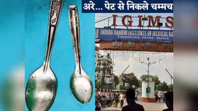 Bihar News: शॉकिंग! बिहार में शख्स के पेट से निकले दो चम्मच, पटना IGIMS के डॉक्टरों का कमाल