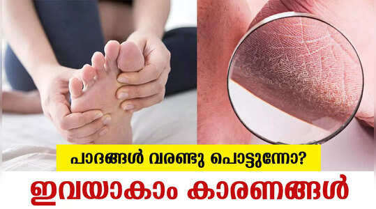 പാദങ്ങൾ വരണ്ട് പൊട്ടാറുണ്ടോ? പരിഹാരം ഇവിടെയുണ്ട്