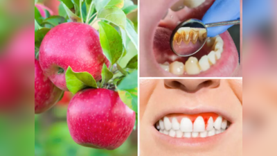 दातांचा ढाचा लोखंडाइतका मजबूत करतात हे 8 उपाय, दुधासारखी चमकते बत्तीशी, हिरड्यांतील सूज, वेदना व रक्त होतं गुल