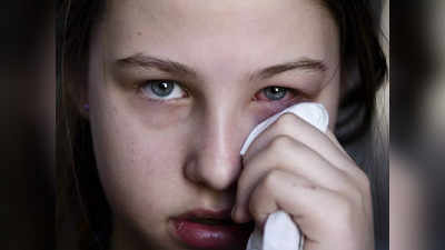 Eye Flu Astro Remedy: চোখ উঠেছে? এই মন্ত্র জপ করলেই সেরে উঠতে পারে চোখের সংক্রমণ