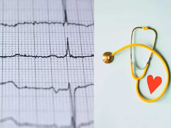 ​எலக்ட்ரோ கார்டியோகிராம் (electrocardiogram)