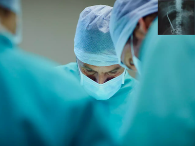 સિઝેરિયન ડિલિવરી બાદ ડોક્ટરો મહિલાના પેટમાં જ કાતર ભૂલી ગયા, 2 ઈંચ જેટલી હતી સાઈઝ