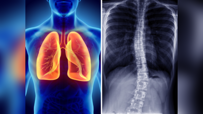 Lung Function Tests: क्या आप स्मोक करते हैं? भागकर अभी करा लें 5 टेस्ट, सड़ने से बच जाएंगे आपके फेफड़े
