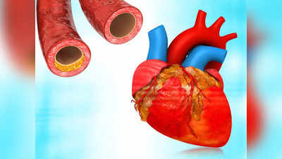 हार्ट अटैक का क्या इलाज है? Dr. ने कोलेस्ट्रॉल को बताया दिल का बड़ा दुश्मन, 4 तरीके साफ करेंगे Bad Cholesterol