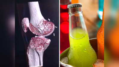 Harmful Drinks For Bones : हाडे मेणासारखी वितळवतात हे 2 पदार्थ, व्हिटॅमिन D व B12 खेचून घेतात, यापुढे विषही फेल