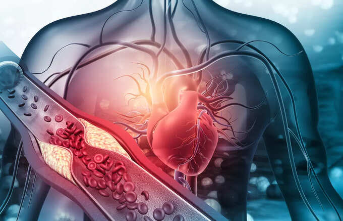 స్టెంట్స్ రకాలు.. స్టెంట్స్ రకాలు..