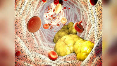 Cholesterol Reducing Foods: दवाओं से तगड़ी हैं ये 5 चीजें, पेट में जाते ही सुखाने लगती हैं गंदा कोलेस्ट्रॉल
