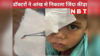 MP News: तीन साल के बच्‍चे की आंख में घुसा कीड़ा, डॉक्‍टरों ने ऑपरेशन कर जिंदा बाहर निकाला