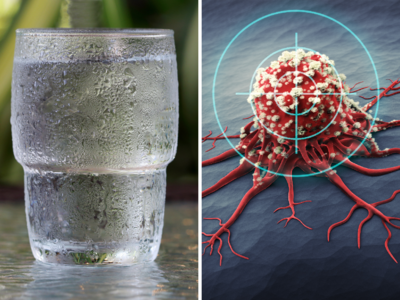 Cancer Prevention: कैंसर का खतरा जीरो कर देगा ठंडे पानी का ये उपाय, शरीर पर तिल वाले जरूर पढ़ें ये टिप्स