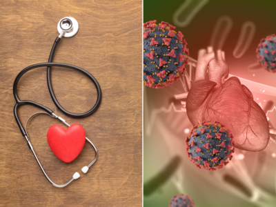 Heart Attack: હાર્ટ એટેક માટે જવાબદાર કોલેસ્ટ્રોલને દૂર કરવા કાર્ડિયોલોજીસ્ટે જણાવ્યા 4 ઉપાય, અજમાવી જૂઓ 