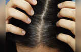 Gray Hair Remedies: চুলের অকালপক্কতা আটকাতে ম্যাজিক দেখায় এই ৭ ঘরোয়া উপাদান, জেনে নিন ঝটপট