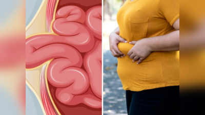 लठ्ठपणा कसा ठरतो हार्नियासाठी कारणीभूत, अनेक आजारांना मिळते आमंत्रण