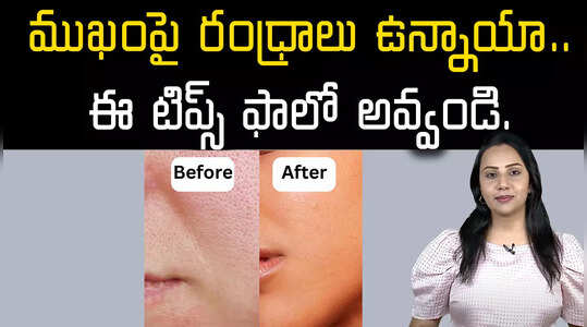 ముఖంపై ఉన్న రంధ్రాలను పోగొట్టడం ఎలా.