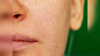Home remedies for open pores: ఓట్స్‌లో ఇది కలిపి మాస్క్‌ వేస్తే.. ఓపెన్‌ పోర్స్‌ కవర్‌ అవుతాయ్‌..!