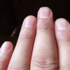 What your nails can reveal about your health | Edward-Elmhurst Health
