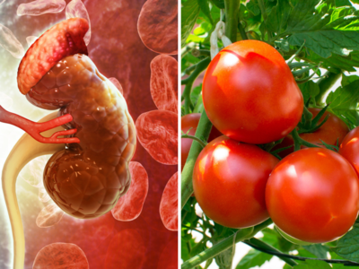 kidney Cleansing Vegetables: किडनी के लिए टॉनिक हैं ये 5 सब्जियां, कोने-कोने से निकाल देंगी विषाक्त पदार्थ