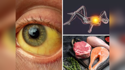 डोळ्यांत दिसतं Vitamin B12 कमीचं हे लक्षण, हे 10 पदार्थ वेळीच खा नाहीतर लाल रक्तपेशी संपून रक्ताच्या नसा आटतील