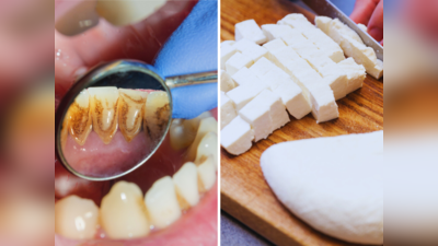Foods For Strong Teeth: दांतों में Calcium भर देती हैं ये 10 चीजें, मजबूत-चमकदार बत्तीसी के लिए जरूर खाएं