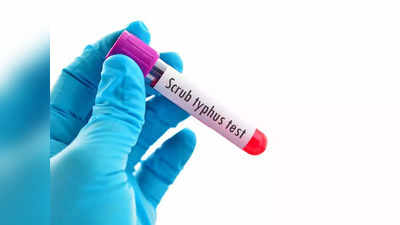 राज्यात स्क्रब टायफसचे १३ रुग्ण; रिकेटशिया जीवाणूपासून पसरतो आजार, जाणून घ्या लक्षणं