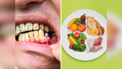 दात आणि हिरड्यांना निरोगी ठेवतात हे पदार्थ, दातांसाठी संतुलित डाएट