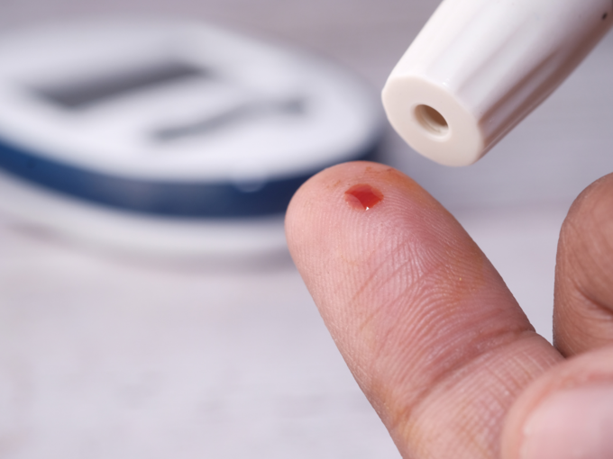 diabetes test blood sugar