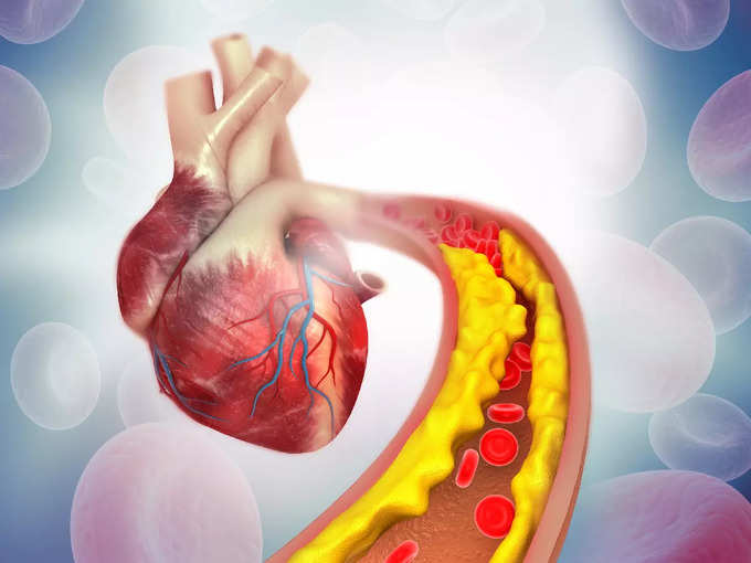 cholesterol heart