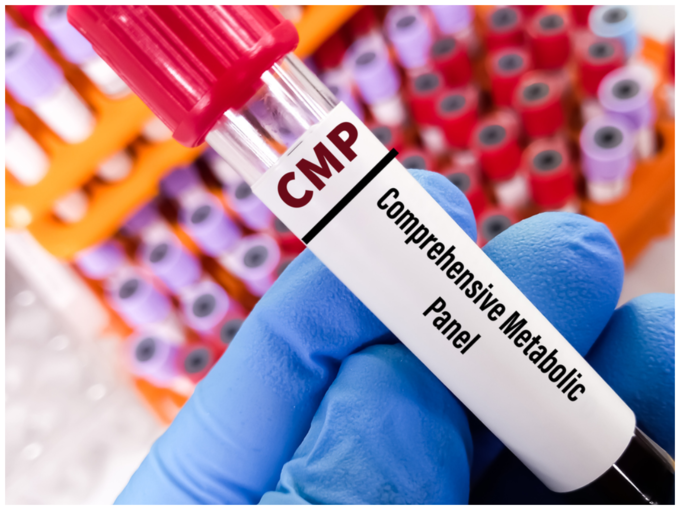 Comprehensive Metabolic Panel(CMP)