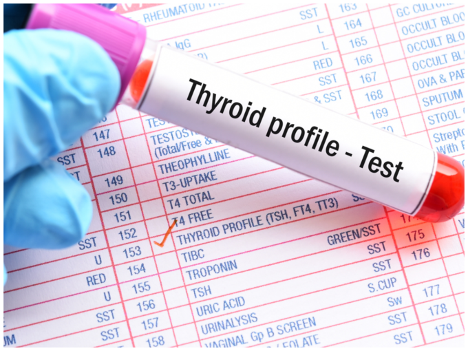 ಥೈರಾಯ್ಡ್ ಪರೀಕ್ಷೆ  