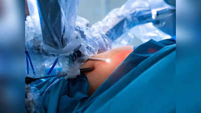 ससून रुग्णालयात लठ्ठपणा कमी करण्याची बॅरिएट्रिक शस्त्रक्रिया यशस्वी