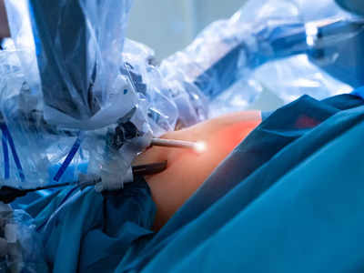 ससून रुग्णालयात लठ्ठपणा कमी करण्याची बॅरिएट्रिक शस्त्रक्रिया यशस्वी