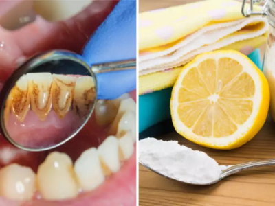 दातांवरचा काळा पिवळा थर मुळापासून साफ करतात हे 5 उपाय, अंधारातही लख्ख चमकते बत्तीशी, तोडांचा घाण वासही होतो दूर