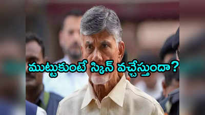 చంద్రబాబుకు వచ్చిన అలర్జీ ప్రాణాంతకమా? ఎంపీ రఘురామ ఆసక్తికర వ్యాఖ్యలు