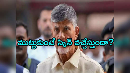 చంద్రబాబుకు వచ్చిన అలర్జీ ప్రాణాంతకమా? ఎంపీ రఘురామ ఆసక్తికర వ్యాఖ్యలు 