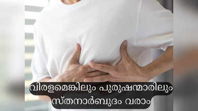 ​പുരുഷന്മാരിലെ സ്തനാര്‍ബുദം: ലക്ഷണവും സാധ്യതയും​