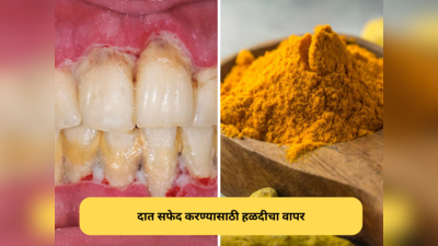७ दिवसात दातावरील पिवळा थर होईल गायब, नैसर्गिक घरगुती उपायांचा करा वापर