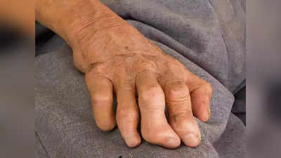 Leprosy: മലപ്പുറത്ത് കുഷ്ഠരോ​ഗം; ഈ ലക്ഷണങ്ങൾ നിങ്ങൾക്കുണ്ടോ? ആശങ്കപ്പെടേണ്ട സാഹചര്യമില്ല, കണ്ടെത്തിയാൽ പൂർണമായും ഭേദമാക്കാം