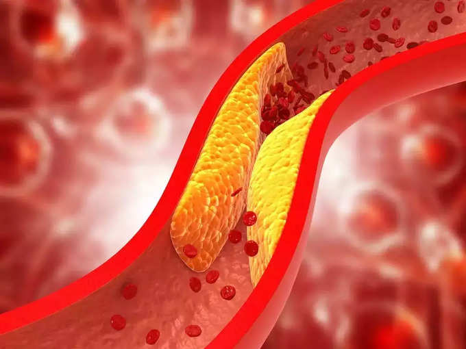 कोलेस्ट्रॉल (cholesterol) क्या है?