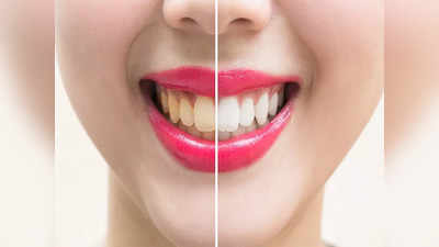 Teeth whitening Tips: ఈ ఆకులు నమిలితే.. మీ పళ్లు మిలమిల మెరుస్తాయ్‌..! టూత్‌ పేస్ట్‌ కూడా సరిపోదు