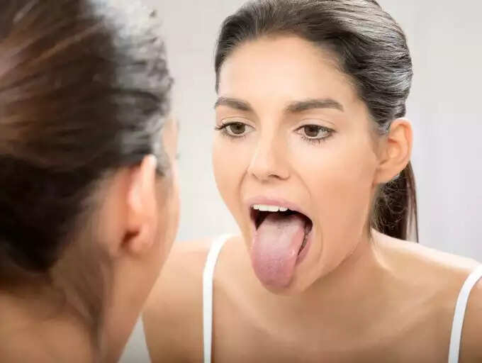 How does covid tongue occur? How does covid tongue occur?