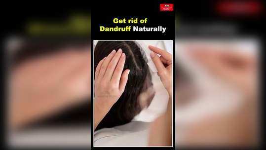 how to get rid of dandruff fast