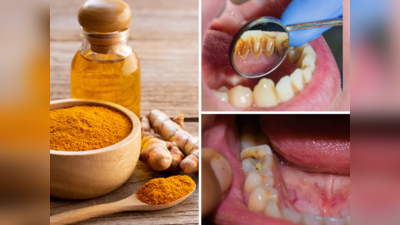 Toothache Ayurvedic Remedy: ​दांतों के दर्द, सड़न और काले कीड़े को जड़ से खत्म करेगा Ayurveda डॉ. का देसी नुस्खा