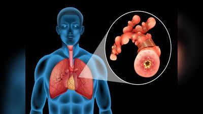 चीन में बच्चों के पीछे पड़ा जल्लाद निमोनिया, भारतीय डॉ. की सलाह- इन 4 तरीकों से डरकर भागेगा Pneumonia