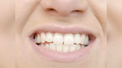 Teeth Personality: দাঁত ঝকঝকে সাদা না হলদেটে? দাঁত দেখেই জানা যায় কোন মানুষ ঠিক কেমন!