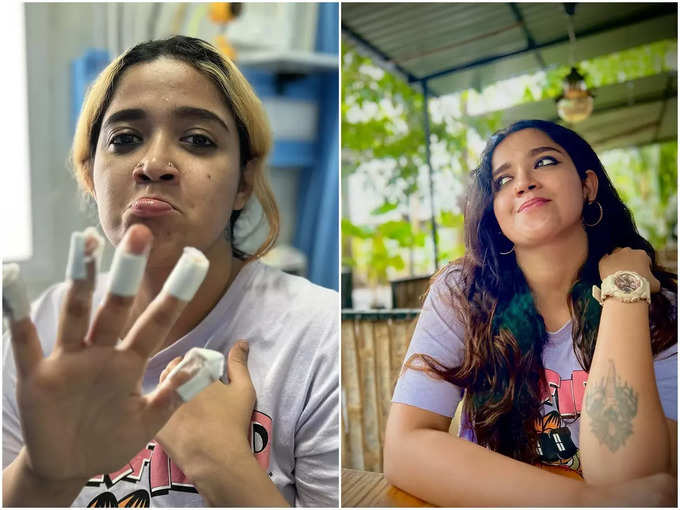 abhirami suresh talks about her hand injury