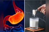 दूध के साथ मिलते ही विषाक्त पदार्थ बन जाती हैं ये 5 चीजें, पेट में भर देंगी जहर